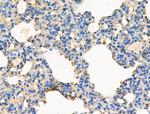 Phospho-KSR2 (Thr497) Antibody in Immunohistochemistry (Paraffin) (IHC (P))