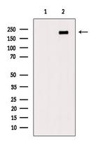 Phospho-LRP5 (Tyr1473) Antibody in Western Blot (WB)