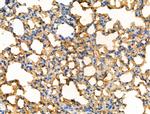 Phospho-CD32 (Tyr288) Antibody in Immunohistochemistry (Paraffin) (IHC (P))