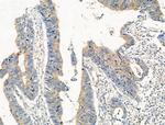 Phospho-LC3B (Thr29) Antibody in Immunohistochemistry (Paraffin) (IHC (P))