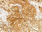 Phospho-LC3B (Thr29) Antibody in Immunohistochemistry (Paraffin) (IHC (P))