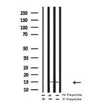 Phospho-LC3B (Thr29) Antibody in Western Blot (WB)