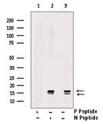 Phospho-LC3B (Thr29) Antibody in Western Blot (WB)