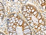 Acetyl-alpha Tubulin (Lys40) Antibody in Immunohistochemistry (Paraffin) (IHC (P))