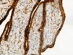 Acetyl-alpha Tubulin (Lys40) Antibody in Immunohistochemistry (Paraffin) (IHC (P))