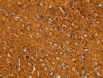 Acetyl-alpha Tubulin (Lys40) Antibody in Immunohistochemistry (Paraffin) (IHC (P))