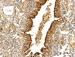 Acetyl-alpha Tubulin (Lys40) Antibody in Immunohistochemistry (Paraffin) (IHC (P))