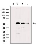 Acetyl-alpha Tubulin (Lys40) Antibody in Western Blot (WB)