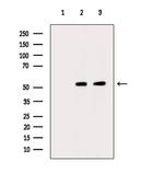 Acetyl-alpha Tubulin (Lys40) Antibody in Western Blot (WB)