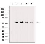 Acetyl-alpha Tubulin (Lys40) Antibody in Western Blot (WB)