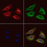 Acetyl-alpha Tubulin (Lys40) Antibody in Immunocytochemistry (ICC/IF)