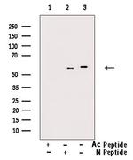 Acetyl-alpha Tubulin (Lys40) Antibody in Western Blot (WB)