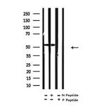 Acetyl-alpha Tubulin (Lys40) Antibody in Western Blot (WB)