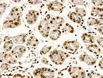 H2BK16ac Antibody in Immunohistochemistry (Paraffin) (IHC (P))