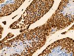 H2BK16ac Antibody in Immunohistochemistry (Paraffin) (IHC (P))