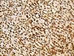 H2BK16ac Antibody in Immunohistochemistry (Paraffin) (IHC (P))