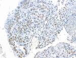 H2BK16ac Antibody in Immunohistochemistry (Paraffin) (IHC (P))