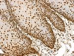 H2BK16ac Antibody in Immunohistochemistry (Paraffin) (IHC (P))