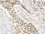 H2BK16ac Antibody in Immunohistochemistry (Paraffin) (IHC (P))