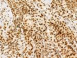 H2BK16ac Antibody in Immunohistochemistry (Paraffin) (IHC (P))