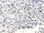 H2BK16ac Antibody in Immunohistochemistry (Paraffin) (IHC (P))