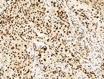 H4K91ac Antibody in Immunohistochemistry (Paraffin) (IHC (P))