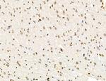 H4K91ac Antibody in Immunohistochemistry (Paraffin) (IHC (P))