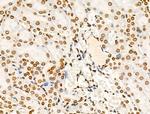 H4K91ac Antibody in Immunohistochemistry (Paraffin) (IHC (P))