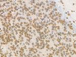 H4K91ac Antibody in Immunohistochemistry (Paraffin) (IHC (P))