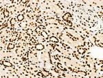 H4K91ac Antibody in Immunohistochemistry (Paraffin) (IHC (P))