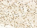 H4K91ac Antibody in Immunohistochemistry (Paraffin) (IHC (P))