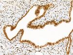 H4K91ac Antibody in Immunohistochemistry (Paraffin) (IHC (P))