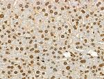 H4K91ac Antibody in Immunohistochemistry (Paraffin) (IHC (P))