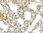 H4K91ac Antibody in Immunohistochemistry (Paraffin) (IHC (P))