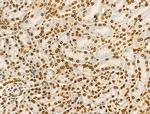 H4K91ac Antibody in Immunohistochemistry (Paraffin) (IHC (P))