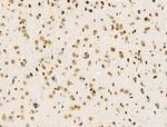 H4K91ac Antibody in Immunohistochemistry (Paraffin) (IHC (P))