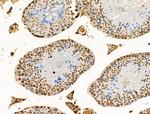 H4K91ac Antibody in Immunohistochemistry (Paraffin) (IHC (P))