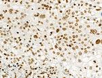 Phospho-Histone H2B (Tyr43) Antibody in Immunohistochemistry (Paraffin) (IHC (P))