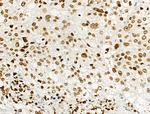 Phospho-Histone H2B (Tyr43) Antibody in Immunohistochemistry (Paraffin) (IHC (P))