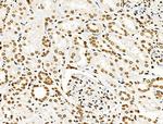 Phospho-Histone H2B (Tyr43) Antibody in Immunohistochemistry (Paraffin) (IHC (P))