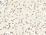 Phospho-Histone H2B (Tyr43) Antibody in Immunohistochemistry (Paraffin) (IHC (P))