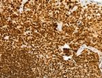 Phospho-Histone H2B (Tyr43) Antibody in Immunohistochemistry (Paraffin) (IHC (P))