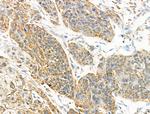 Acetyl-SOD2 (Lys122) Antibody in Immunohistochemistry (Paraffin) (IHC (P))