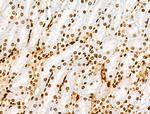 H3K122ac Antibody in Immunohistochemistry (Paraffin) (IHC (P))