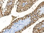 H3K122ac Antibody in Immunohistochemistry (Paraffin) (IHC (P))