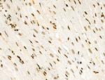 H3K122ac Antibody in Immunohistochemistry (Paraffin) (IHC (P))