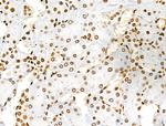 H3K122ac Antibody in Immunohistochemistry (Paraffin) (IHC (P))