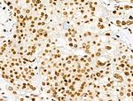 H3K122ac Antibody in Immunohistochemistry (Paraffin) (IHC (P))