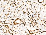 H3K122ac Antibody in Immunohistochemistry (Paraffin) (IHC (P))