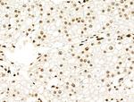 H3K122ac Antibody in Immunohistochemistry (Paraffin) (IHC (P))